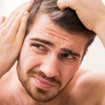 Hair-Loss-in-Men